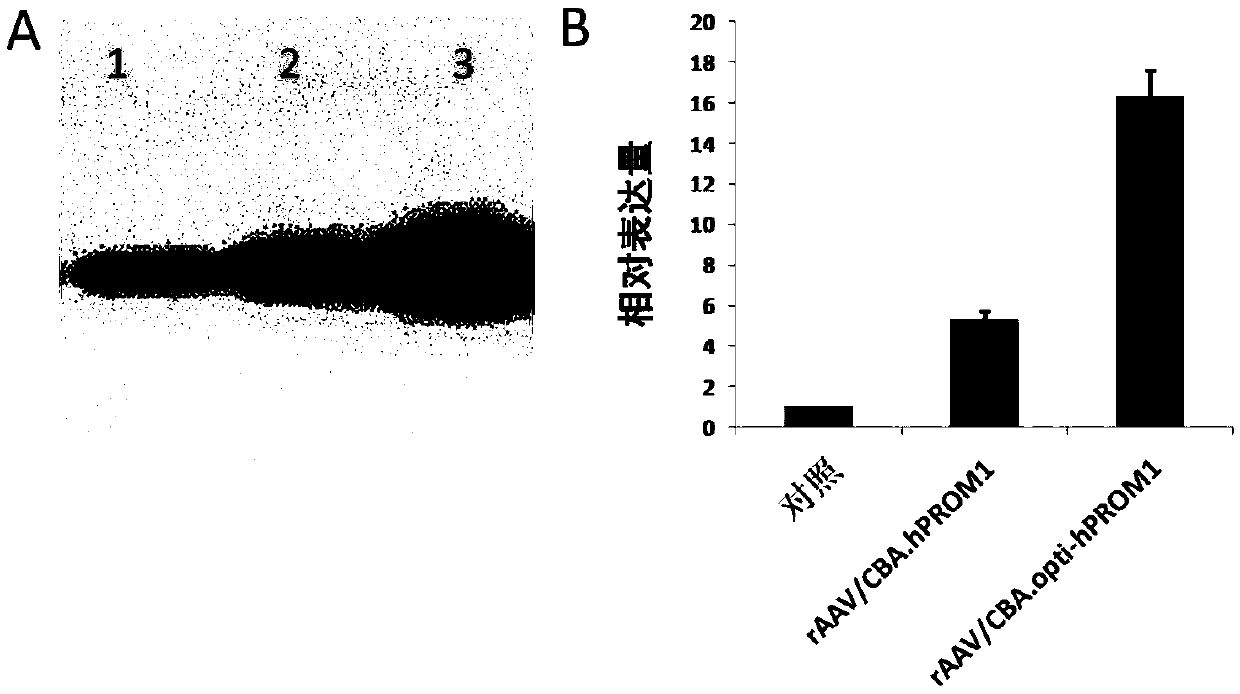 Gene therapy carrier for treating retinitis pigmentosa diseases