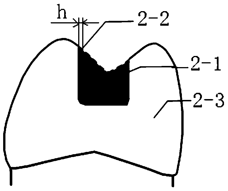 Color partition type tooth preparation training model