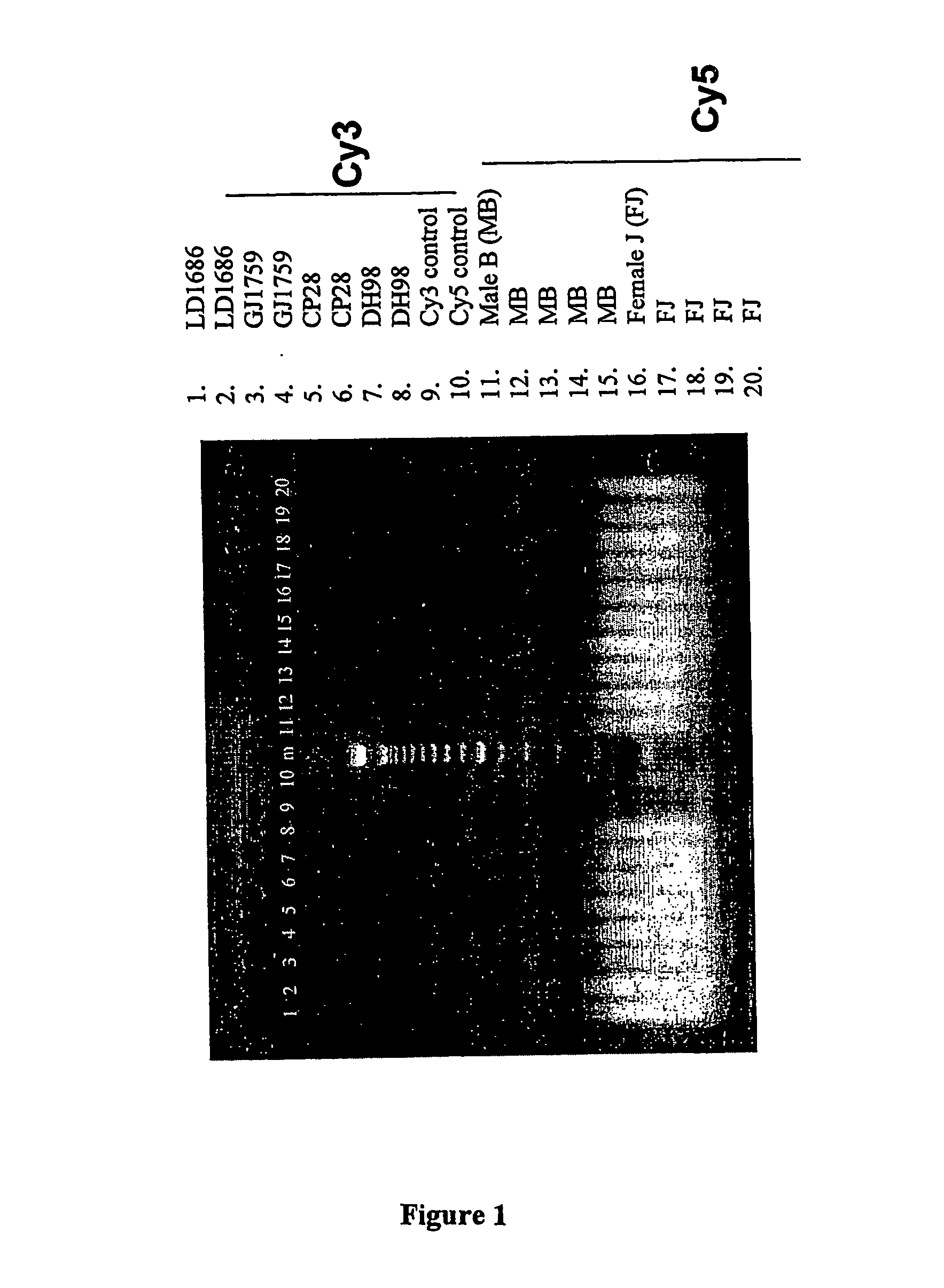 Prenatal Diagnosis Using Cell-Free Fetal DNA in Amniotic Fluid