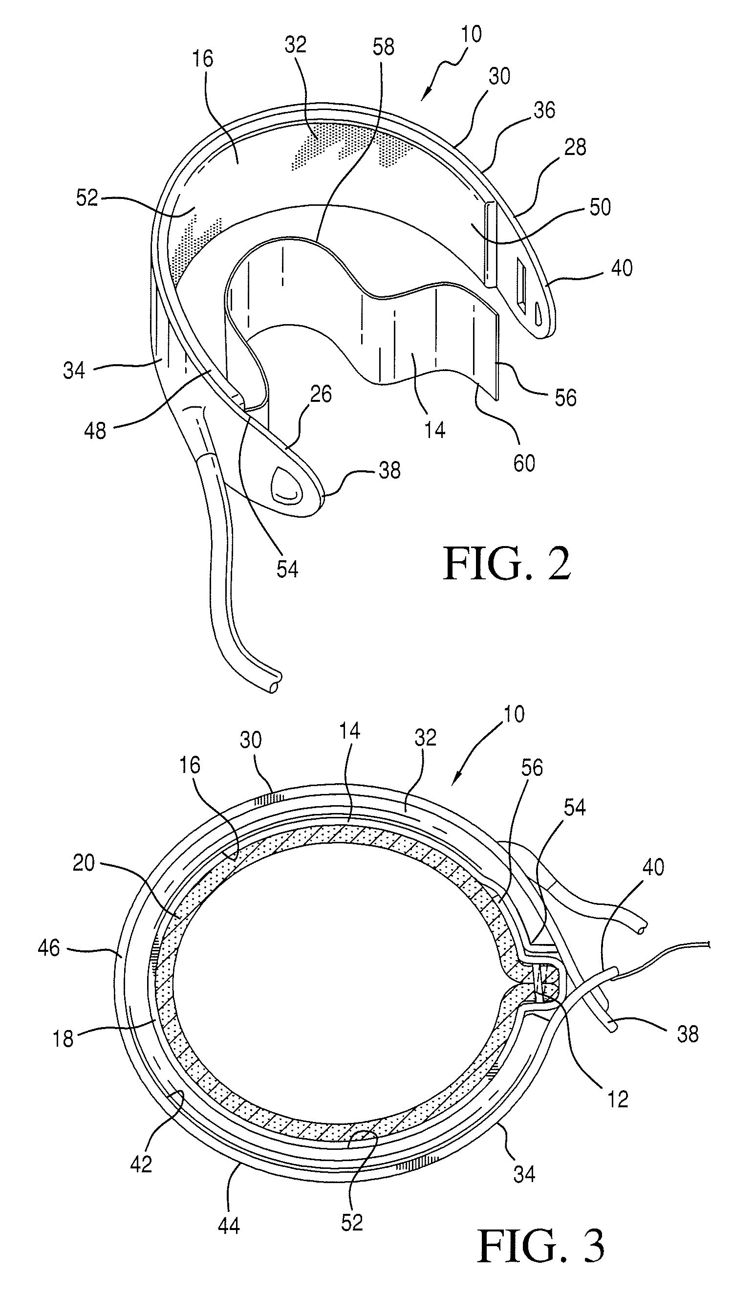 Implantable restriction device with spacer