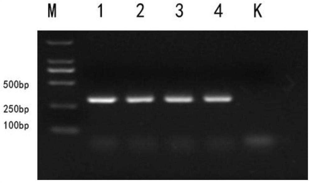 PCR detection method and kit for tularemia and its subspecies