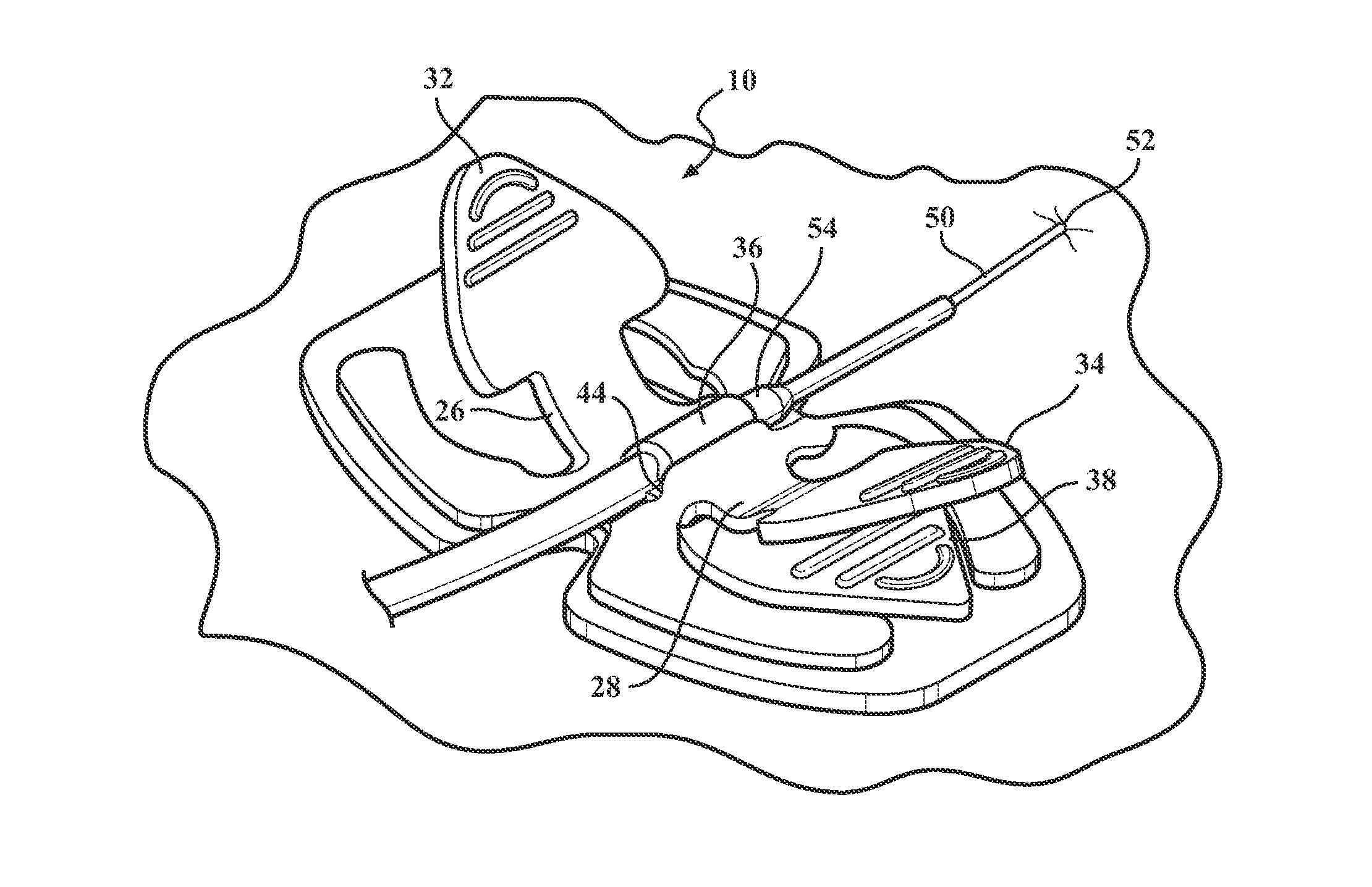 Catheter securement device with slit between first and second pull tabs