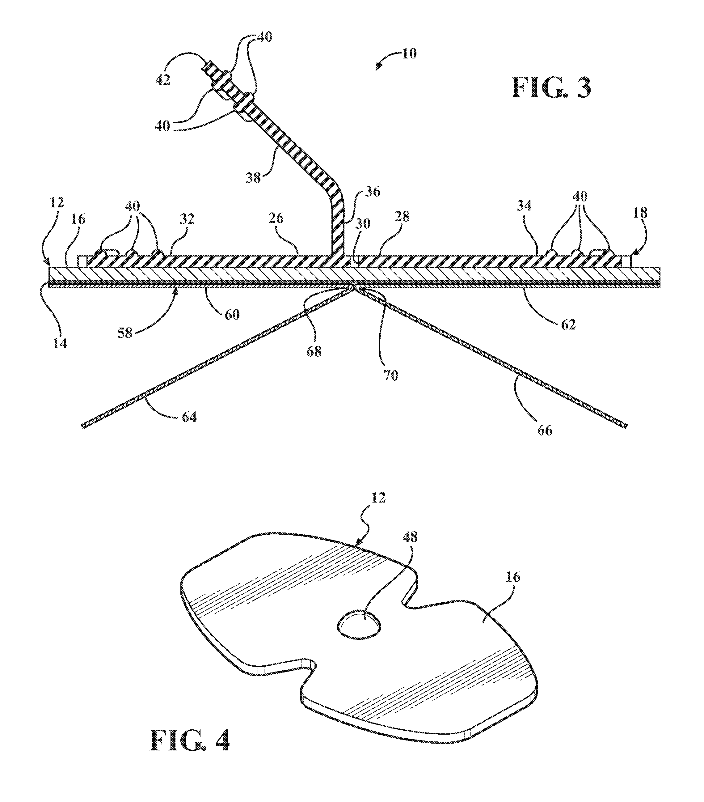 Catheter securement device with slit between first and second pull tabs