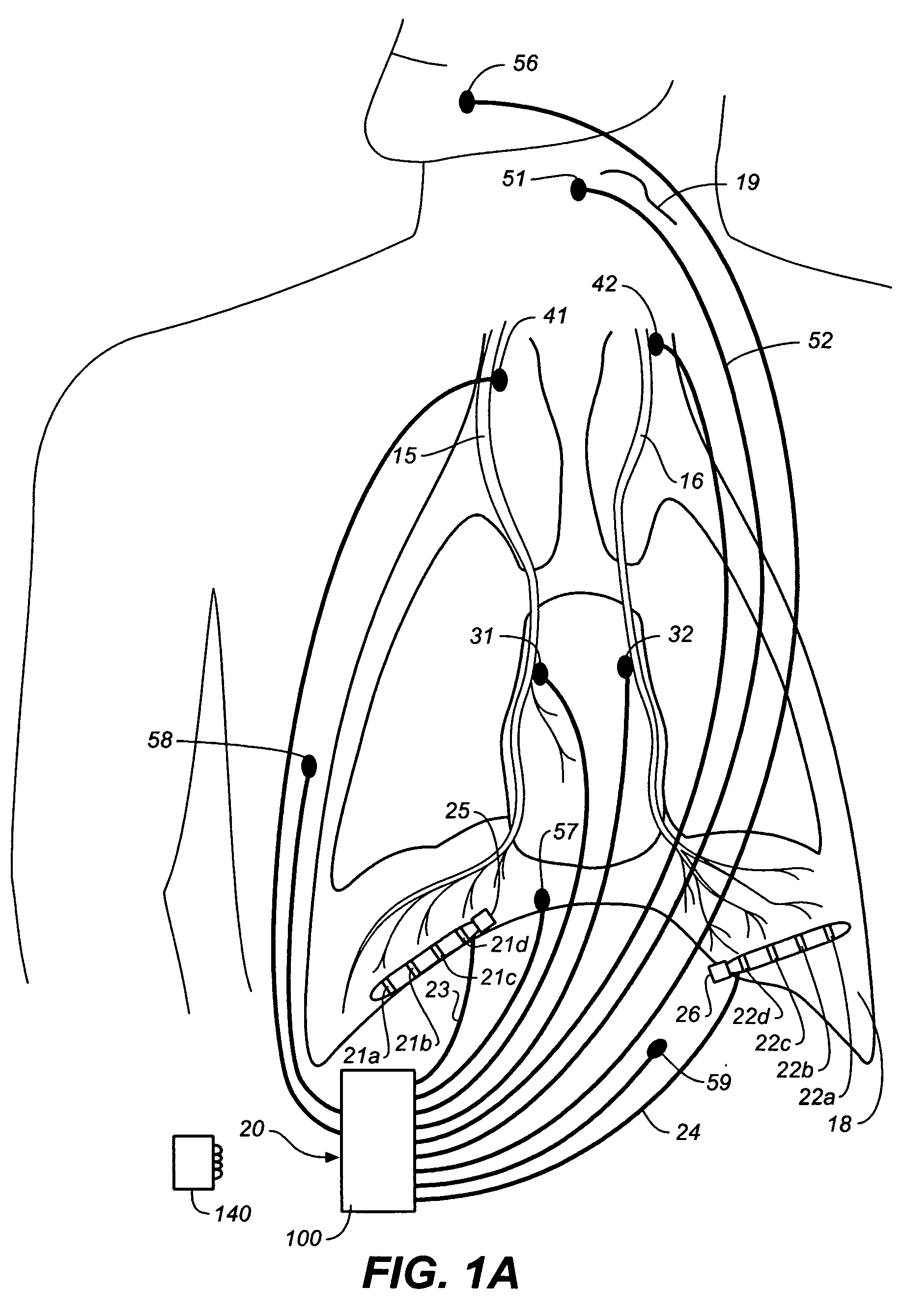 Multimode device and method for controlling breathing