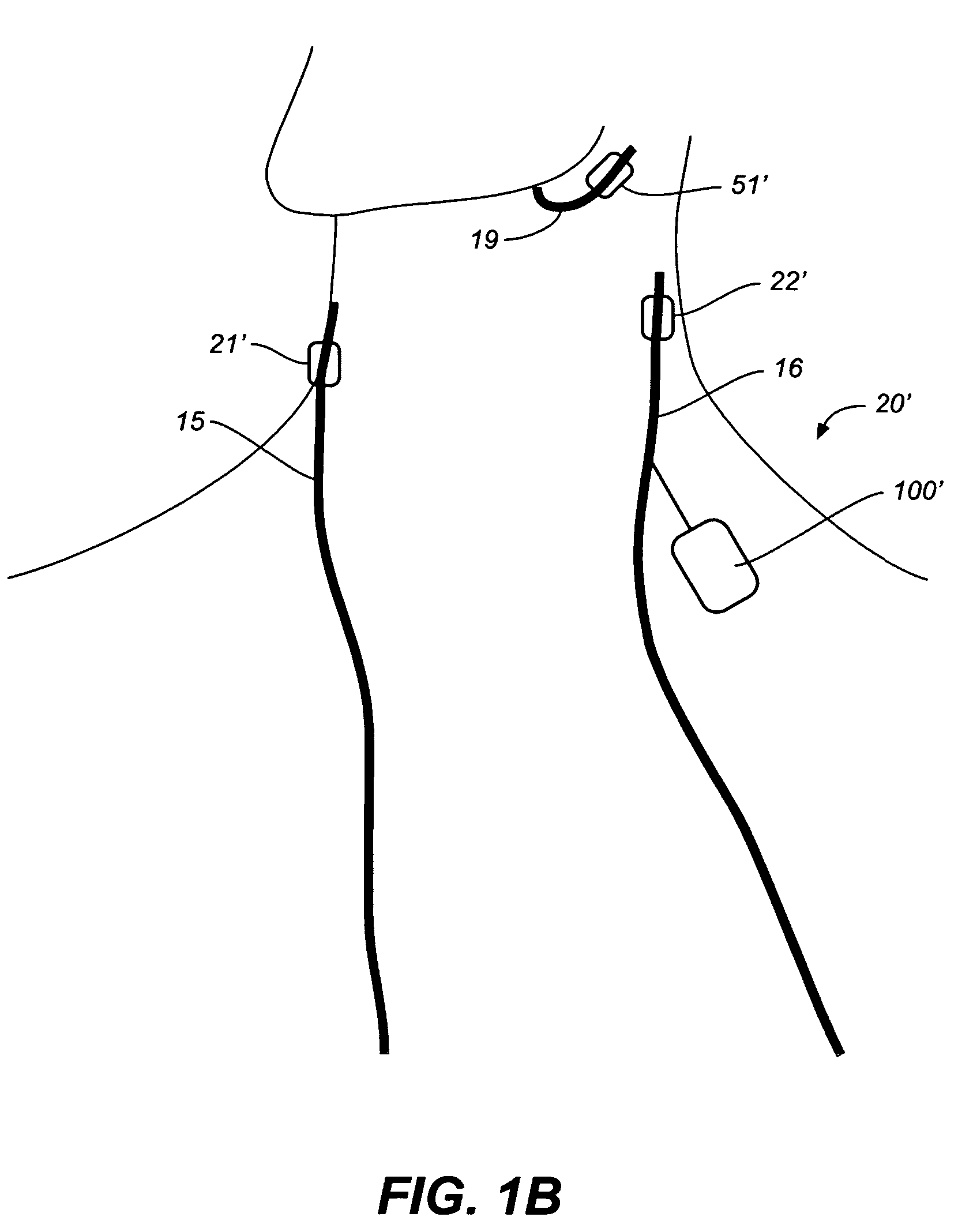 Multimode device and method for controlling breathing