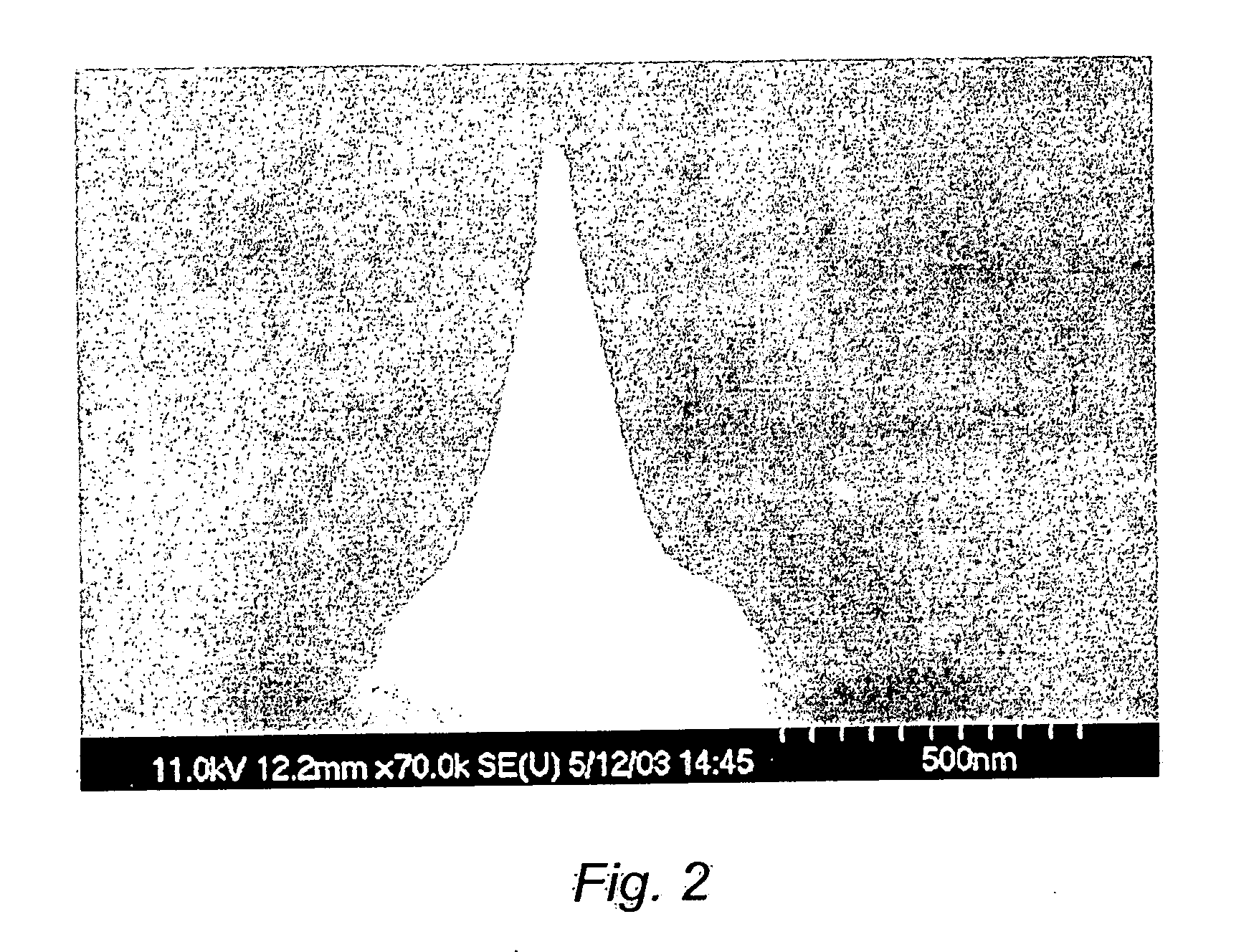 Method and system for the prediction of cardiac arrhythmias, myocardial ischemia, and other diseased condition of the heart associated with elevated sympathetic neural discharges