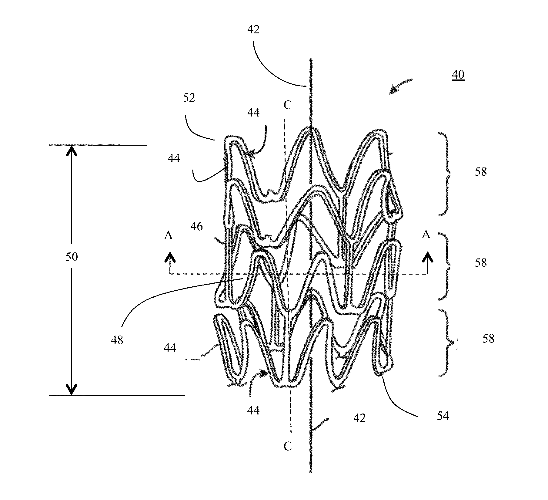 Bioresorbable Stent