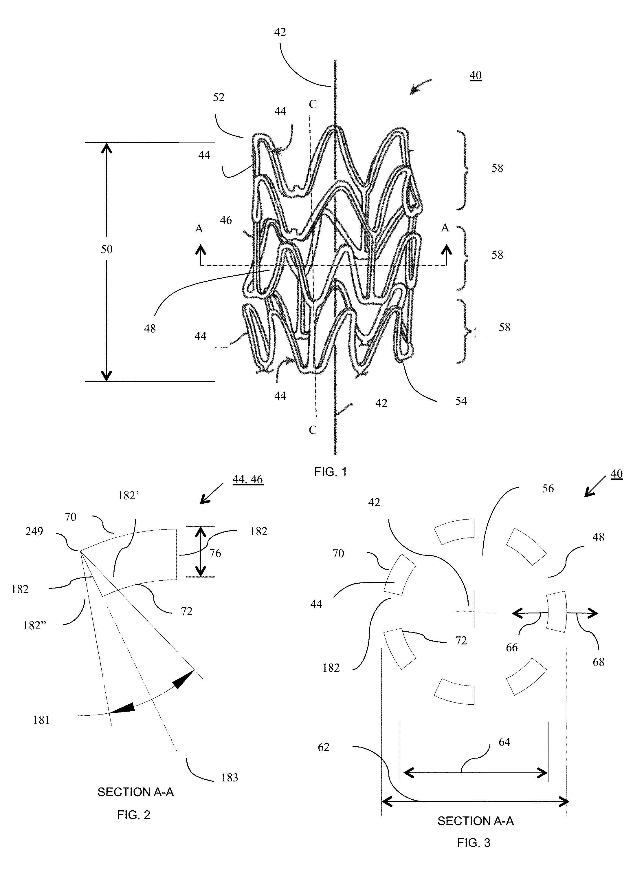 Bioresorbable Stent