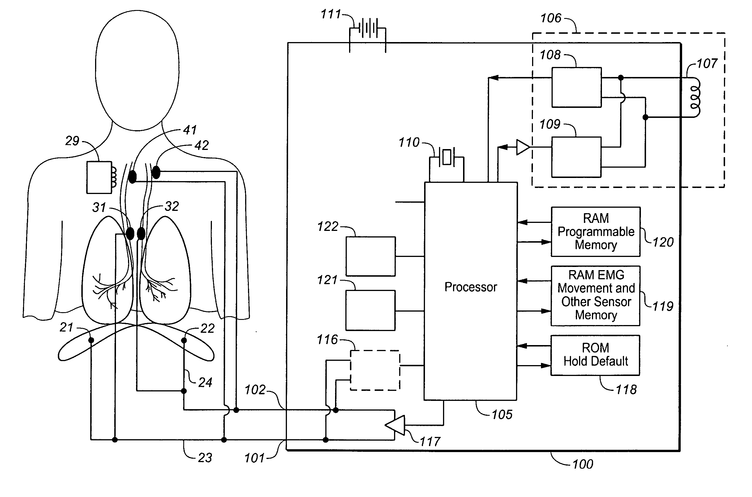 Device and method for improving upper airway functionality