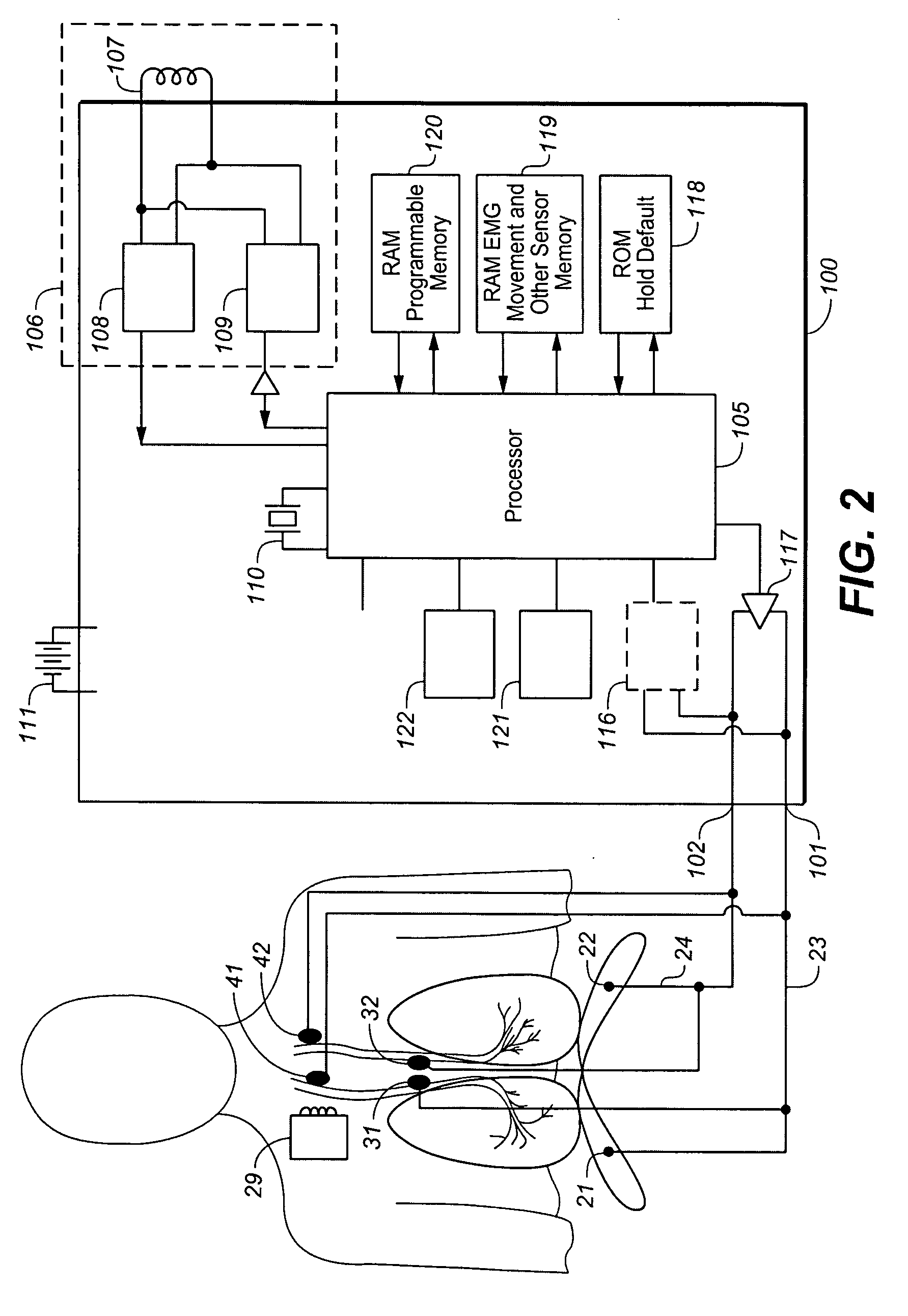 Device and method for improving upper airway functionality