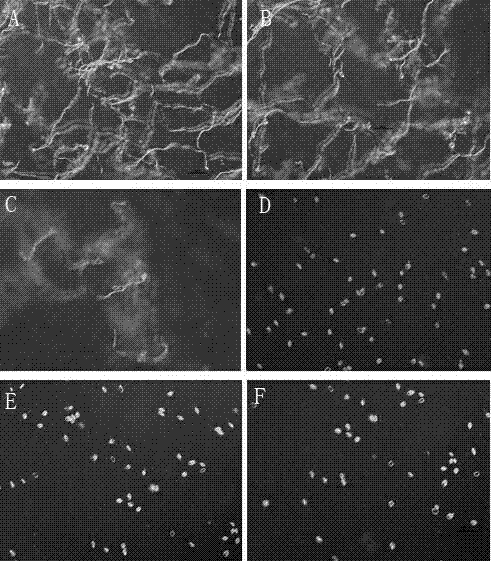 Application of Dickeya Zeae antibiotic zeamines in control of plant diseases