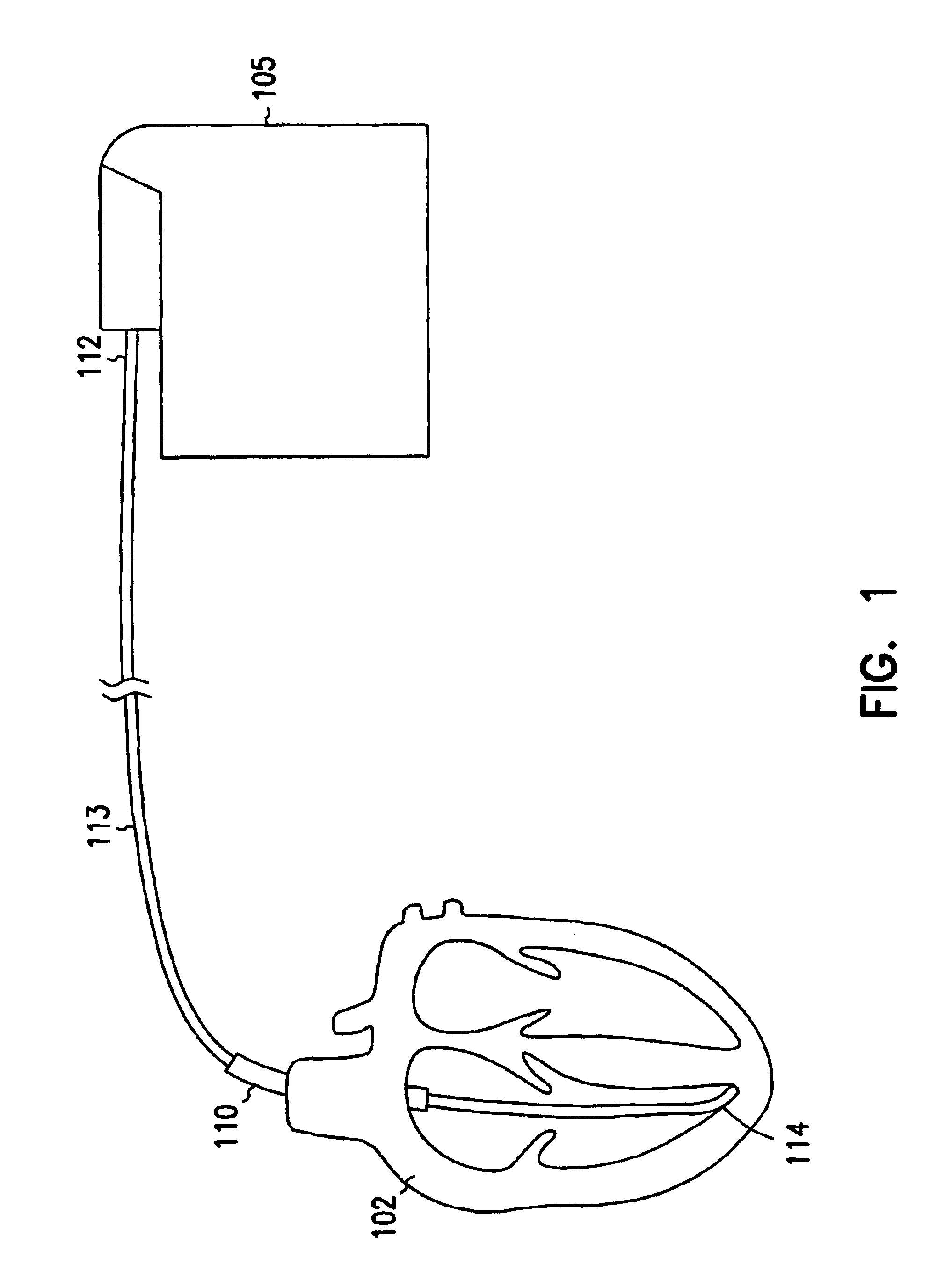 Extendable and retractable lead having a snap-fit terminal connector