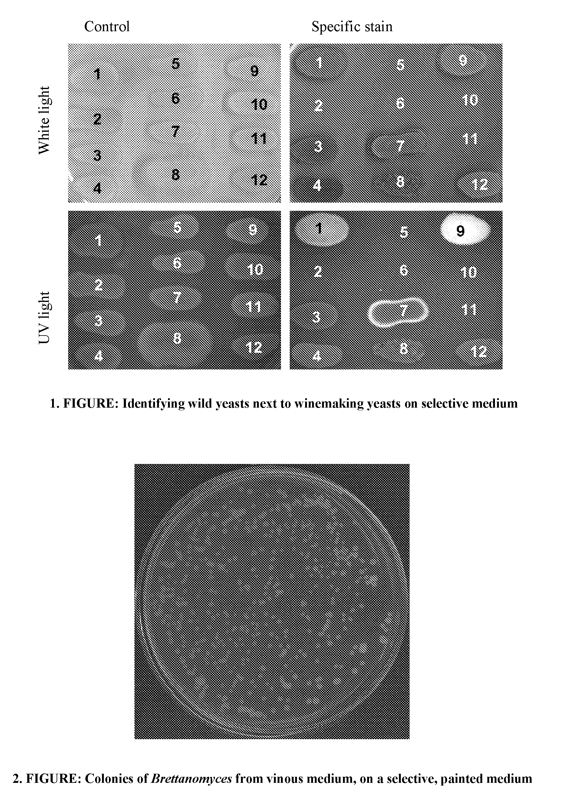 Selective chromogenic medium