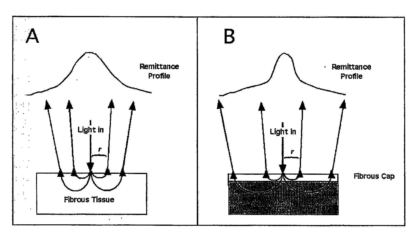 Method and apparatus for determination of atherosclerotic plaque type by measurement of tissue optical properties