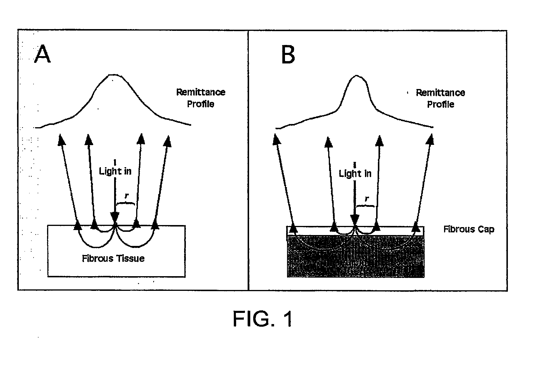 Method and apparatus for determination of atherosclerotic plaque type by measurement of tissue optical properties