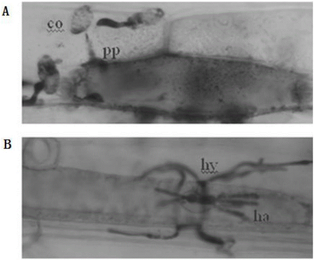 NLR gene NLR1-V, expression vector thereof and application of NLR gene NLR1-V and expression vector thereof