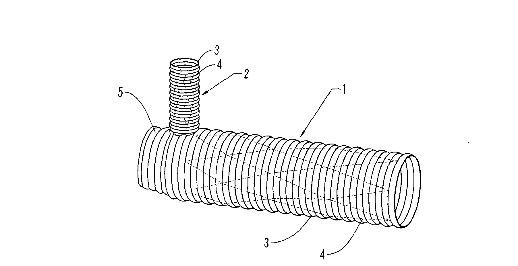 Branch artificial blood vessel bracket applied in surgery