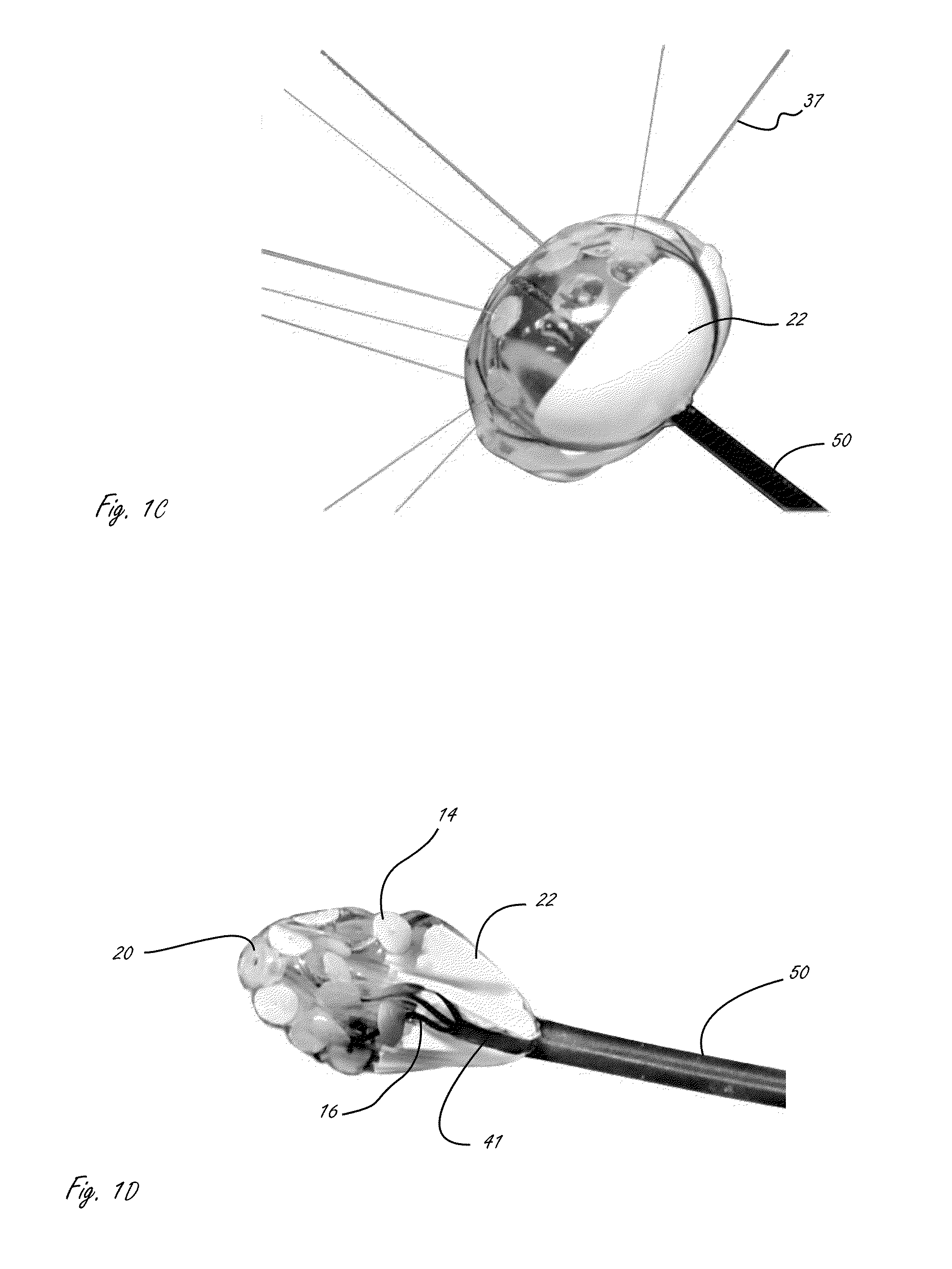 Visualization inside an expandable medical device