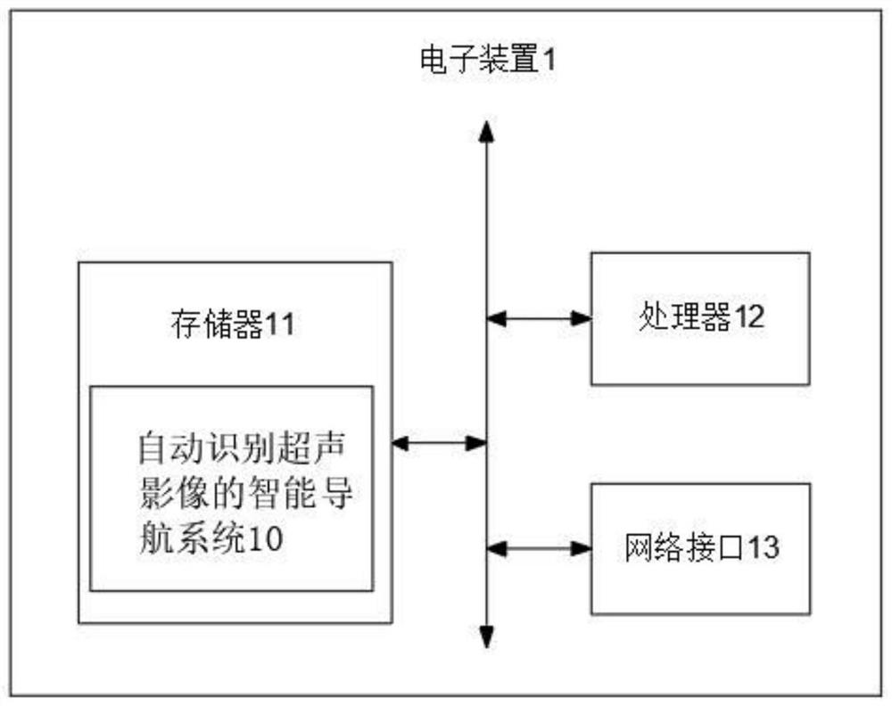 Intelligent navigation system capable of automatically identifying ultrasonic images, electronic device and storage medium