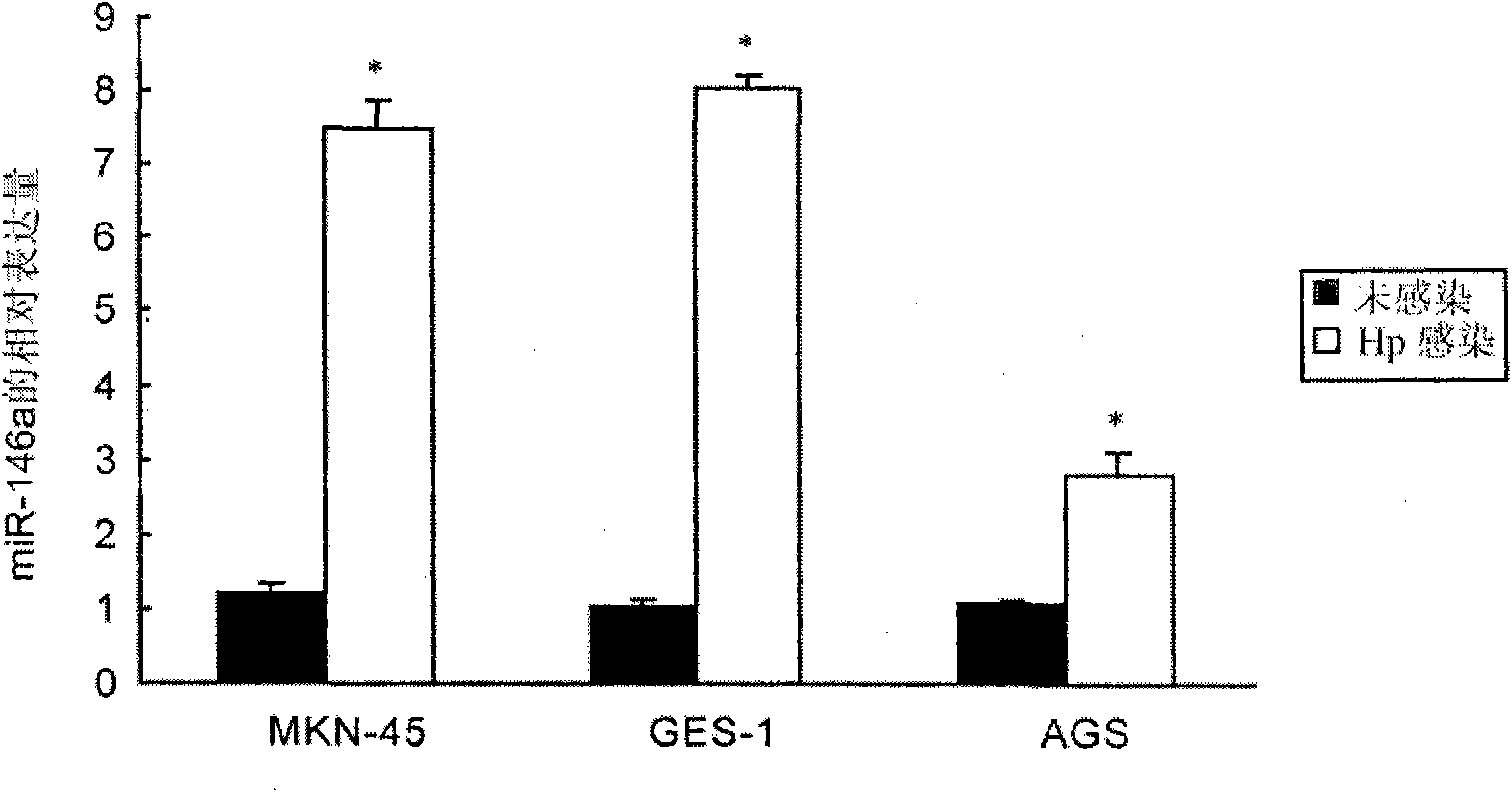 Application of miR-146a in preparing medicine for curing gastricism