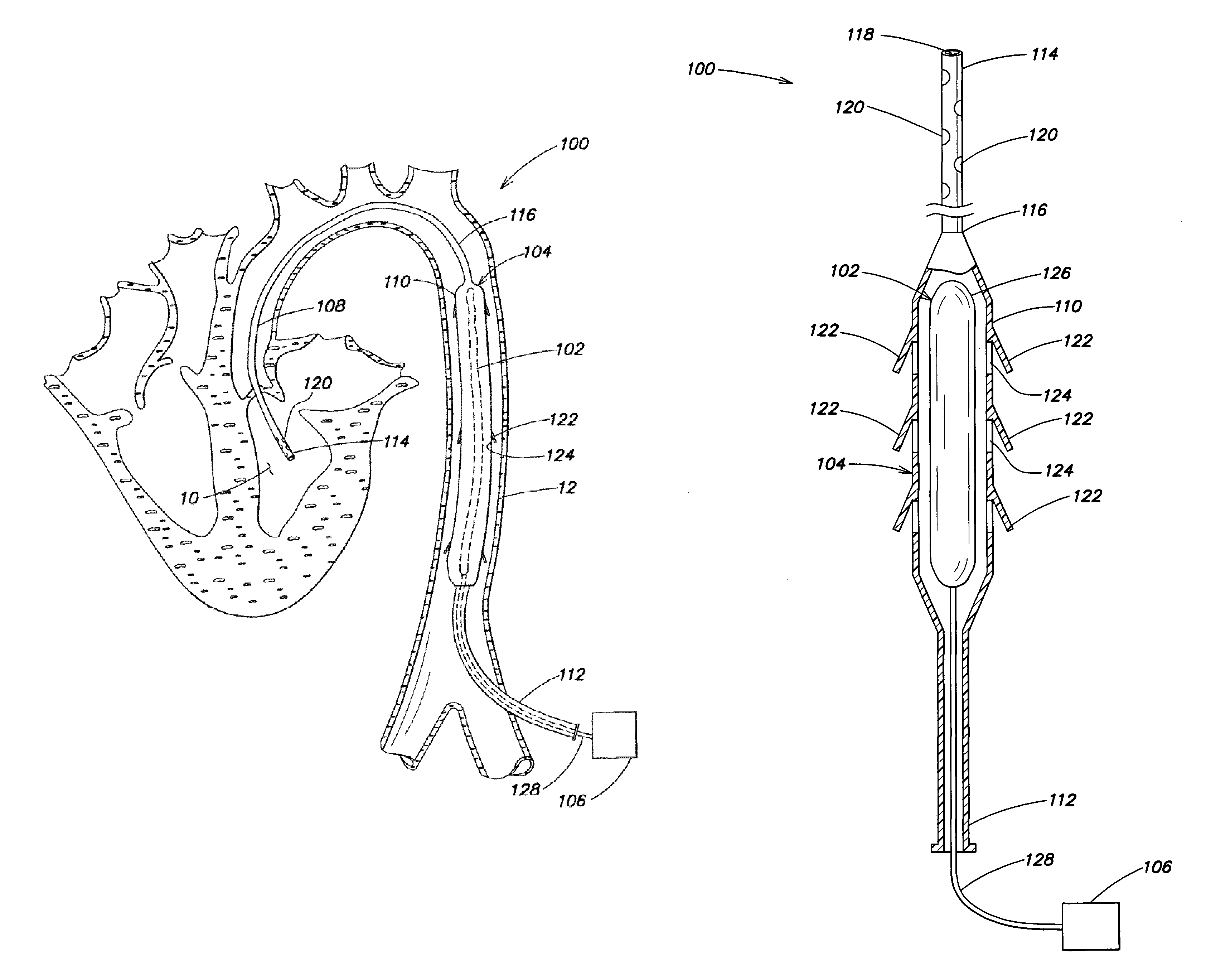 Method and apparatus for pumping blood