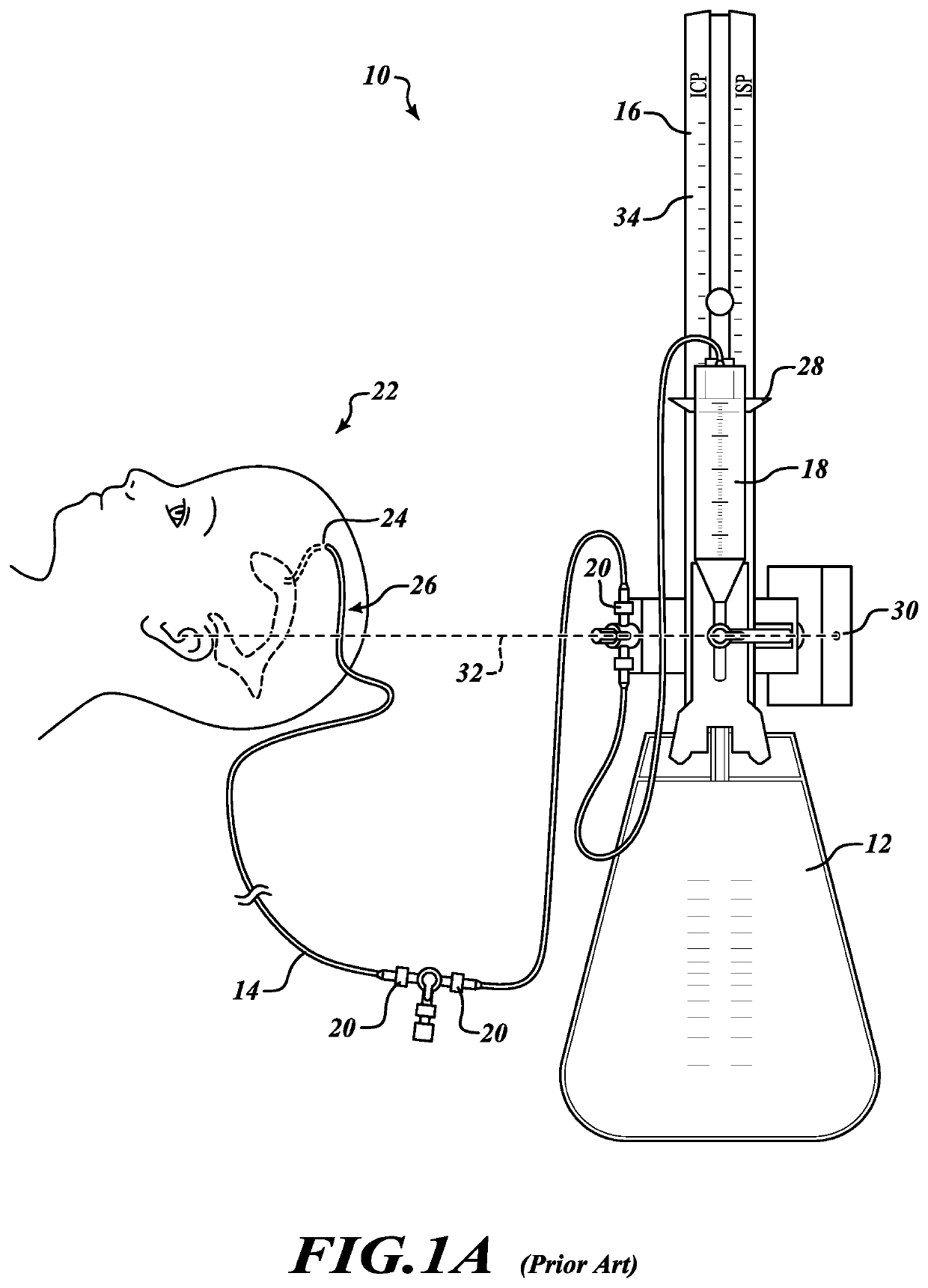 System and method for automatically adjusting an external ventricular drain