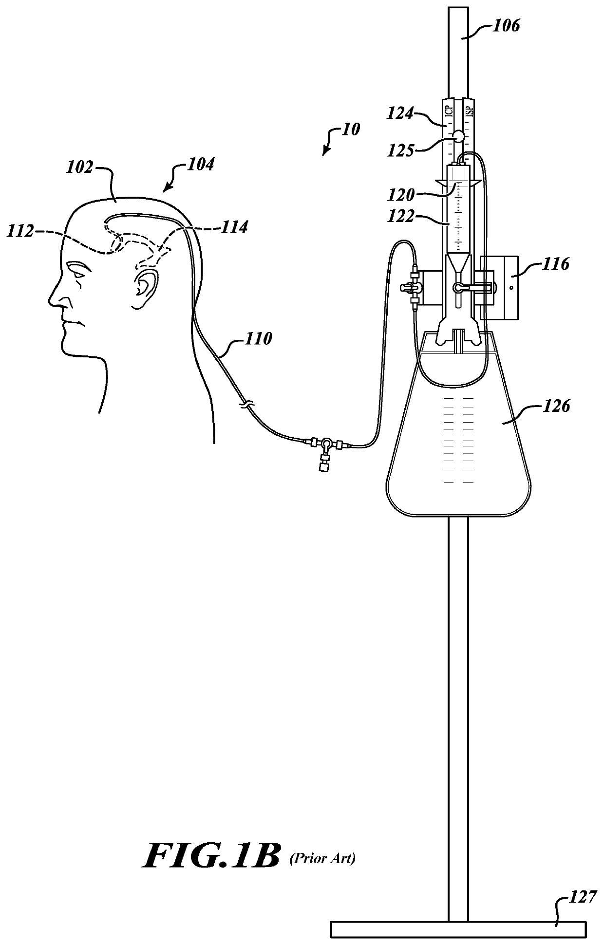 System and method for automatically adjusting an external ventricular drain