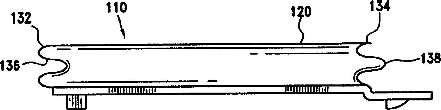 Gastric band with mating end profiles