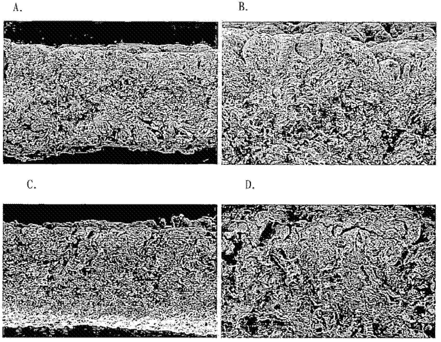 Production method for cryopreserved acellular dermal matrix, and cryopreserved acellular dermal matrix produced thereby