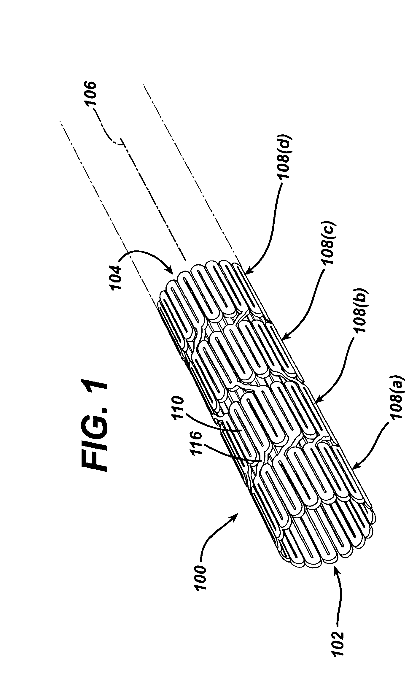 Anvil bridge stent design