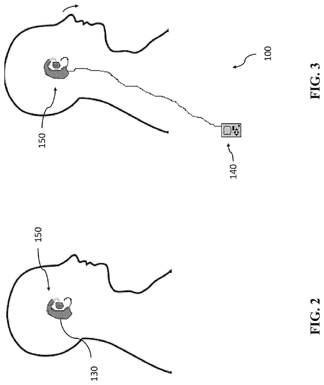 Systems and methods for treating tinnitus and enhancing hearing