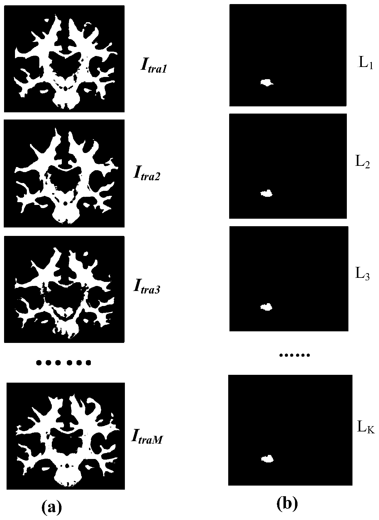 A Multi-Atlas Image Segmentation Method Based on Orientation and Scale Descriptors