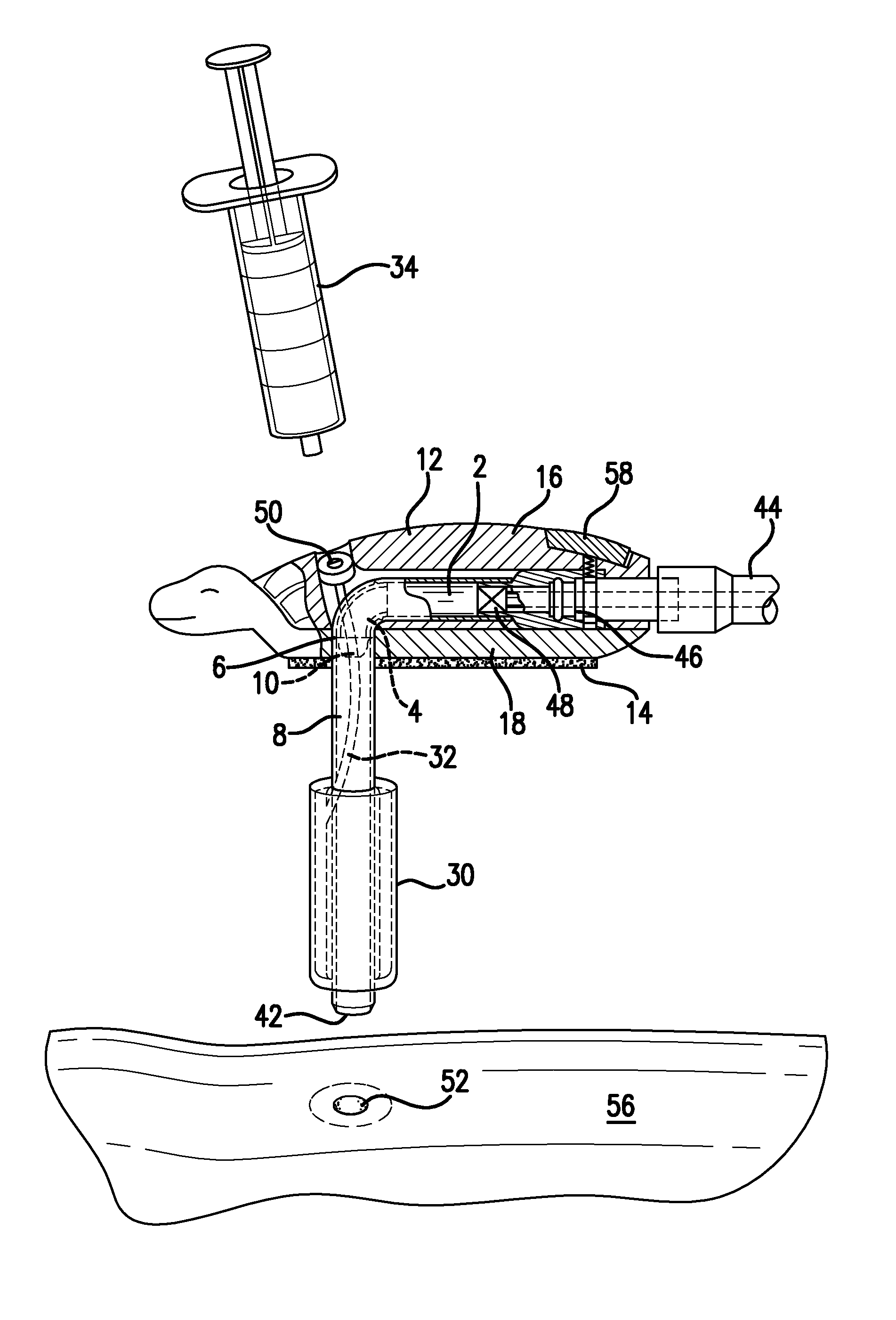 Enteral feeding tube and housing