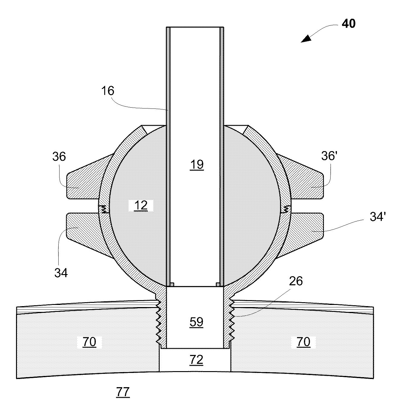 Method and apparatus for directed device placement in the cerebral ventricles or other intracranial targets