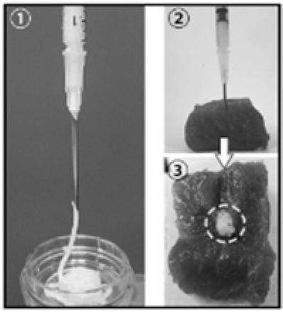 Application of nano porous microbracket in tissue regeneration and repair