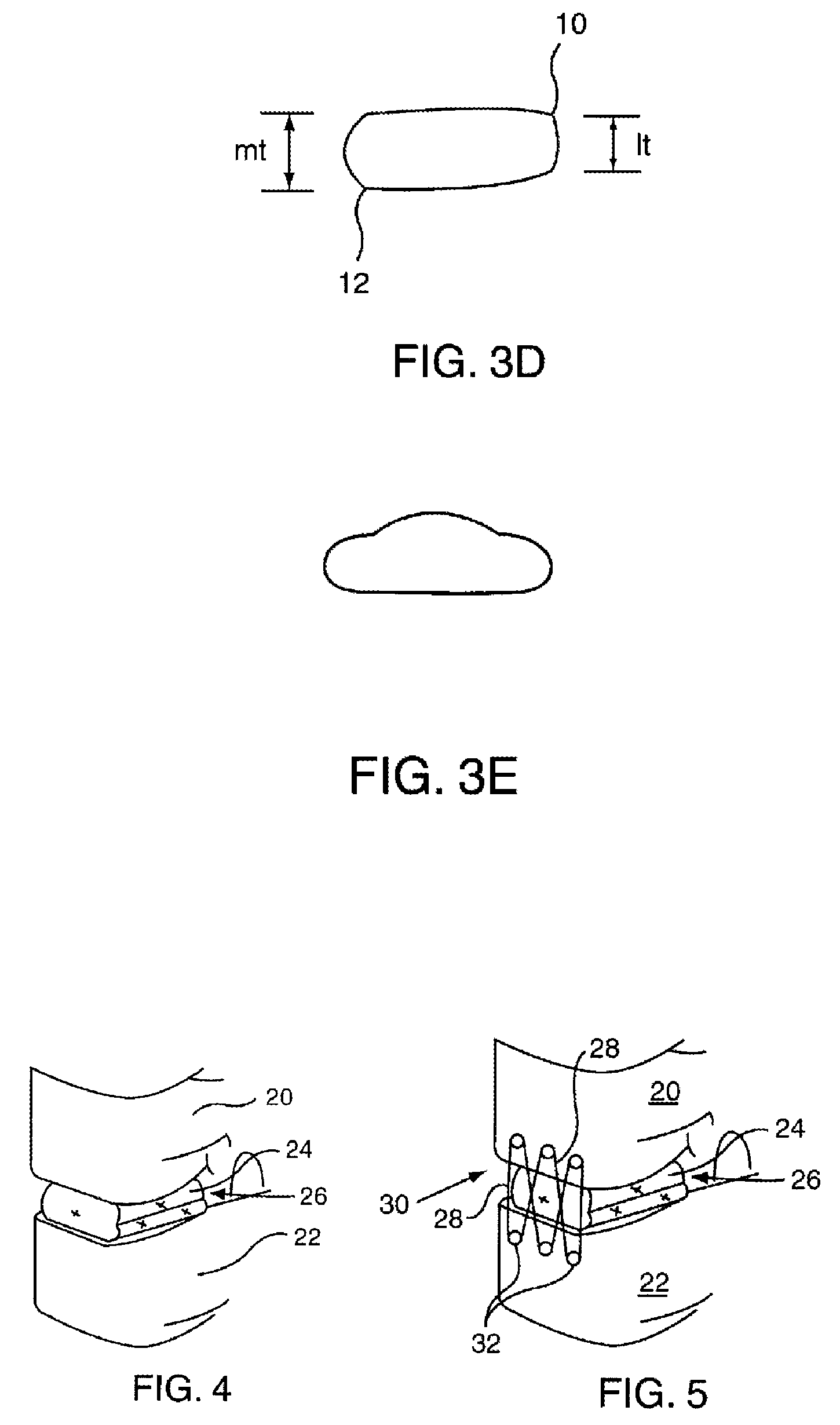 Bioresorbable spinal implant and related methods