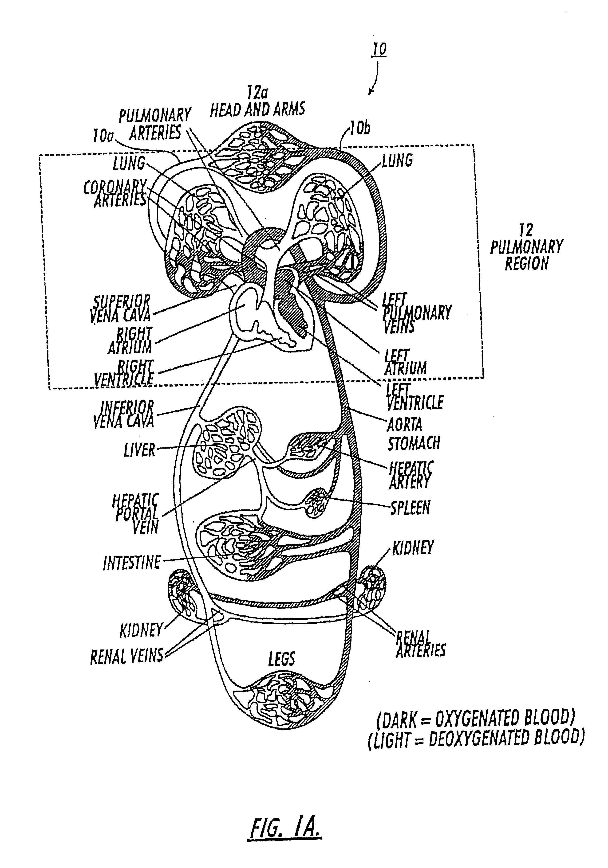 Diagnostic procedures using direct injection of gaseous hyperpolarized 129Xe and associated systems and products