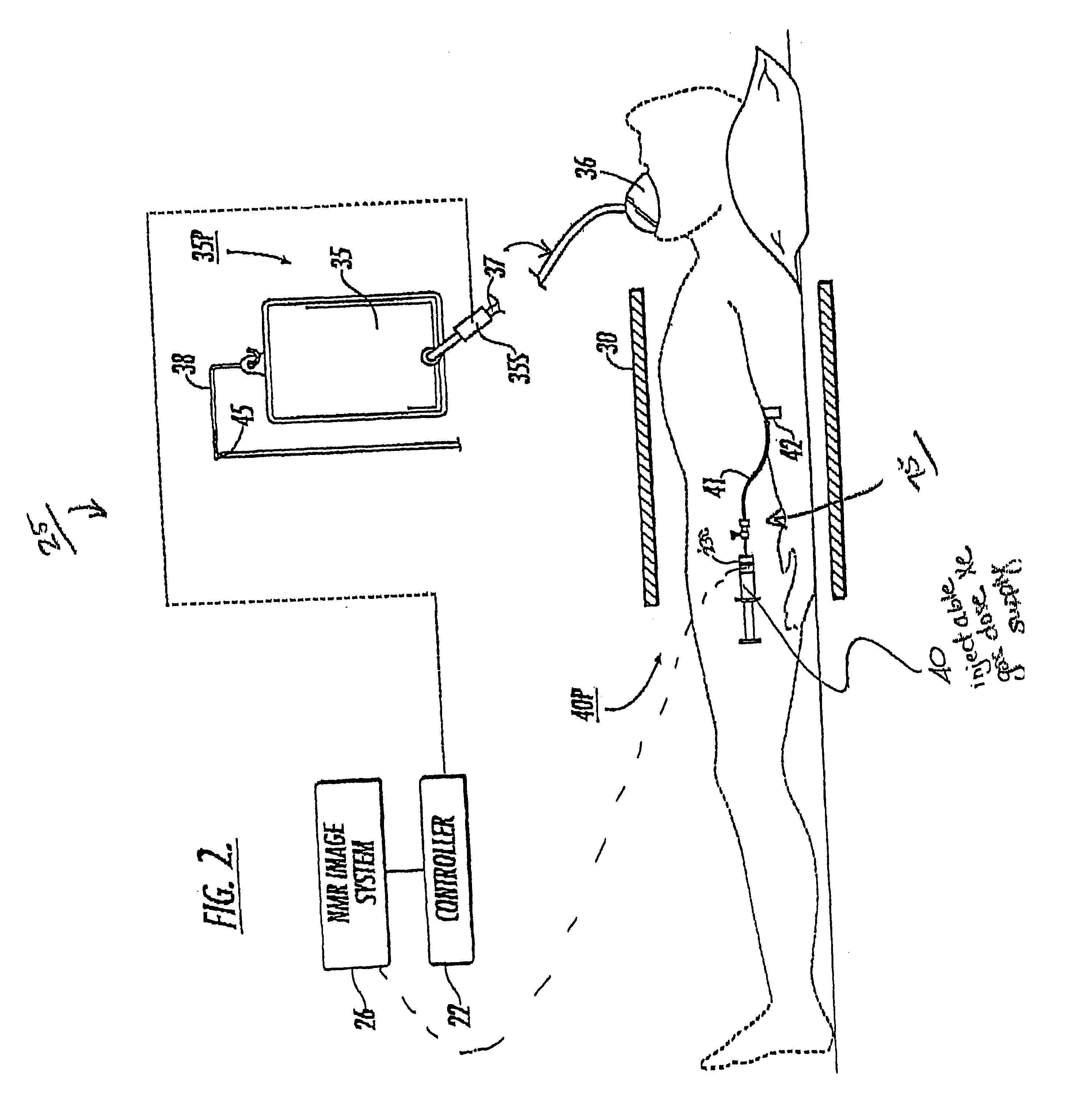 Diagnostic procedures using direct injection of gaseous hyperpolarized 129Xe and associated systems and products