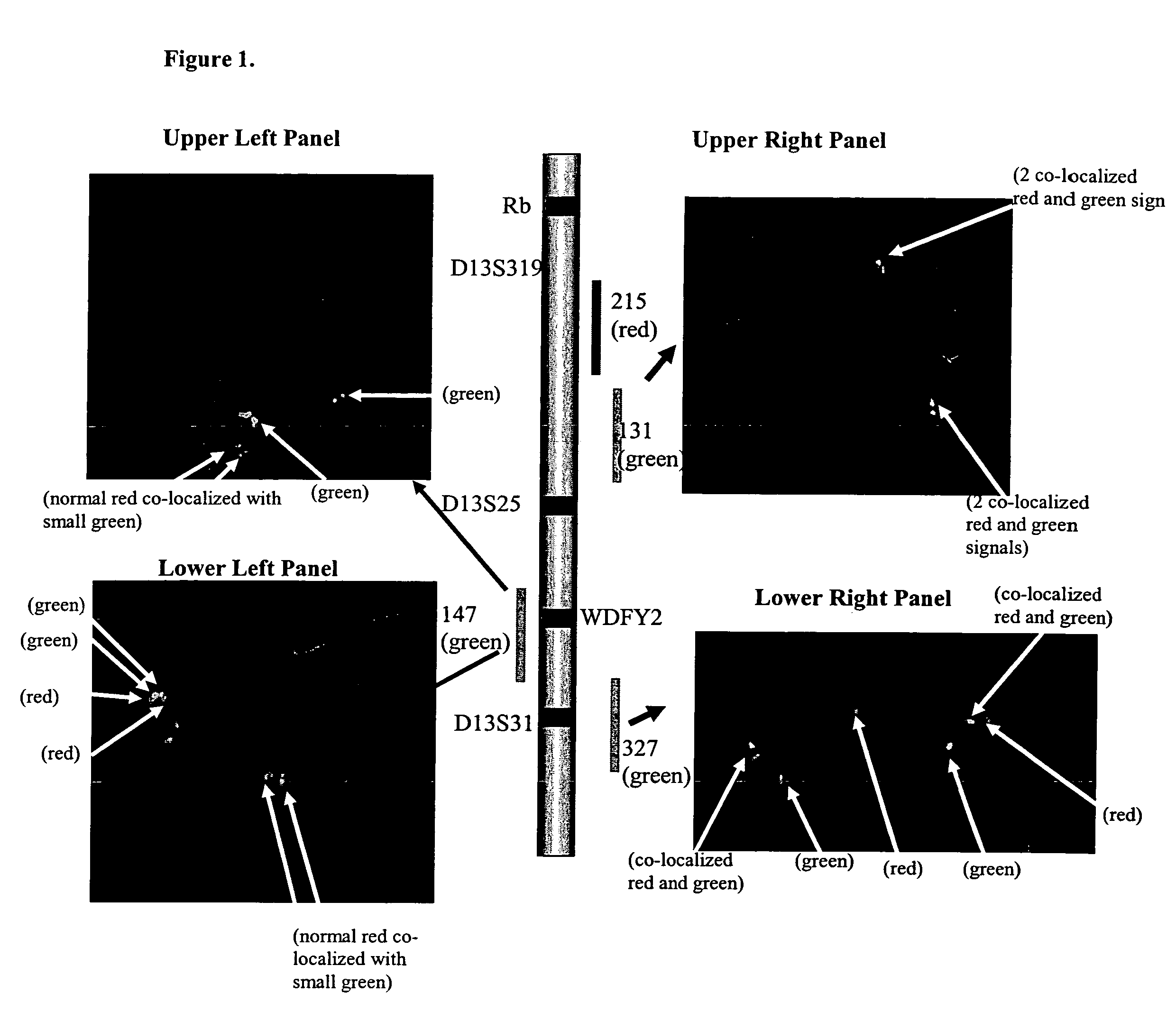 Detection of 13q14 chromosomal alterations