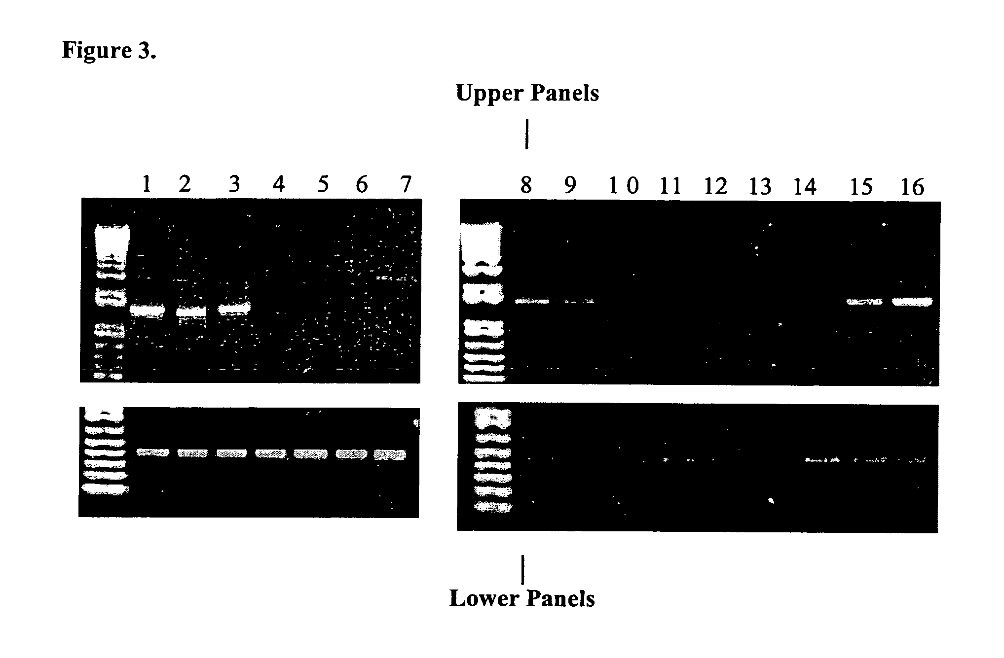 Detection of 13q14 chromosomal alterations