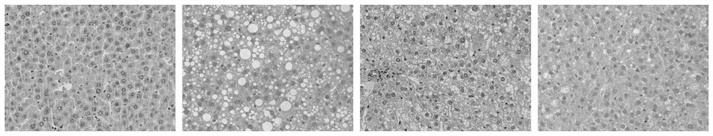 Application of HPA in preparation of medicine for treating non-alcoholic fatty liver disease