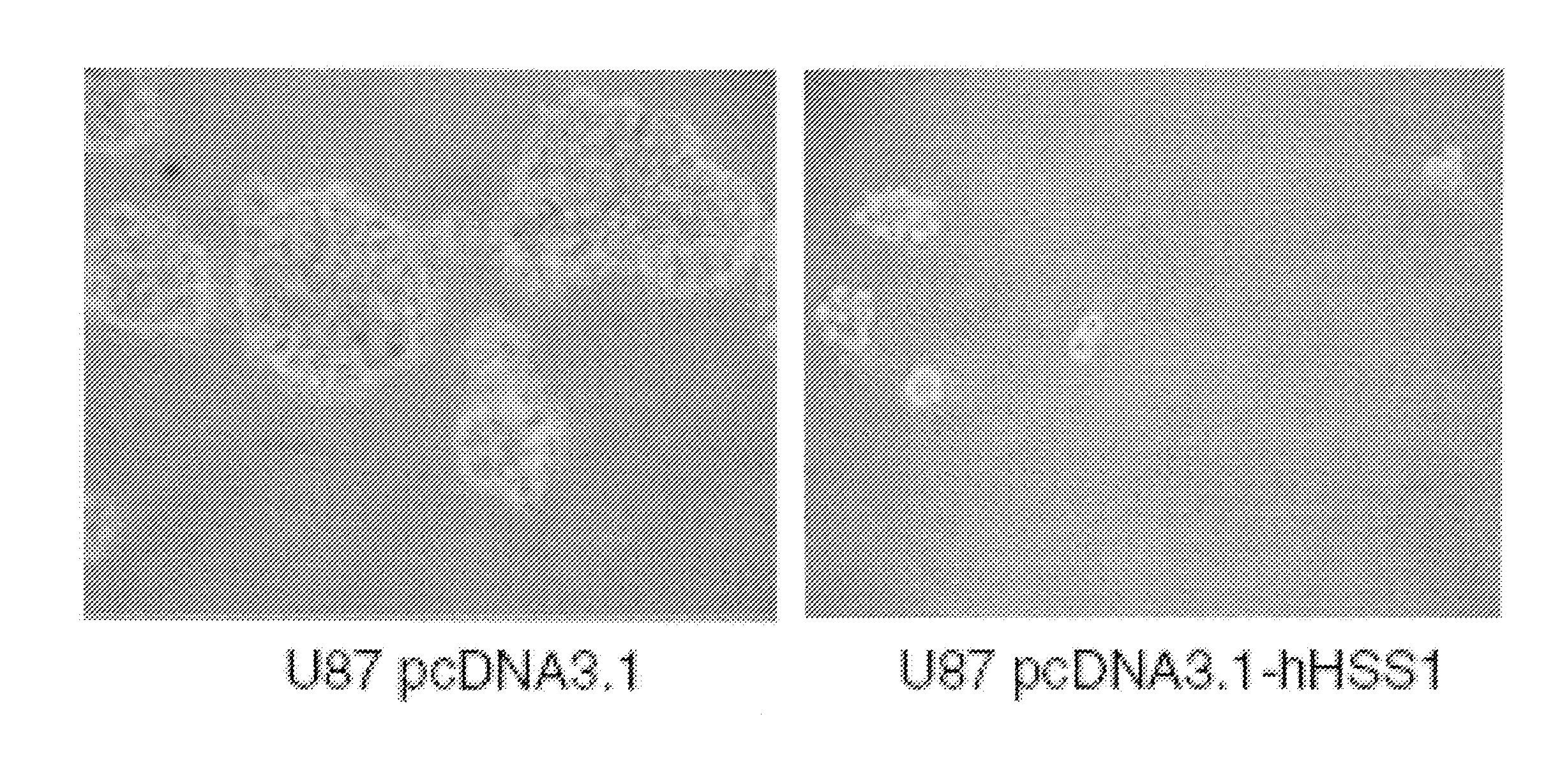 Method for treating brain cancer using a novel tumor suppressor gene and secreted factor