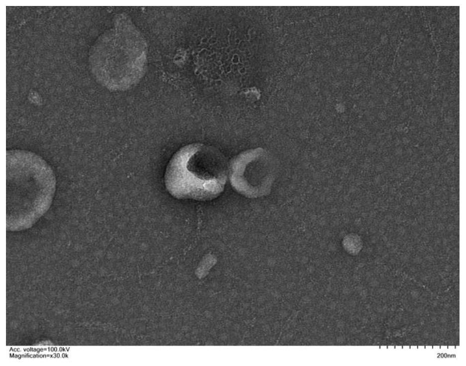 Gene-loaded exosome as well as preparation method and application thereof