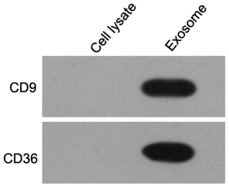 Gene-loaded exosome as well as preparation method and application thereof