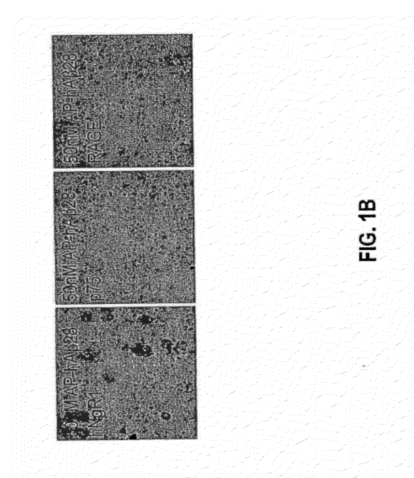 Methods Relating to Peripheral Administration of Nogo Receptor Polypeptides