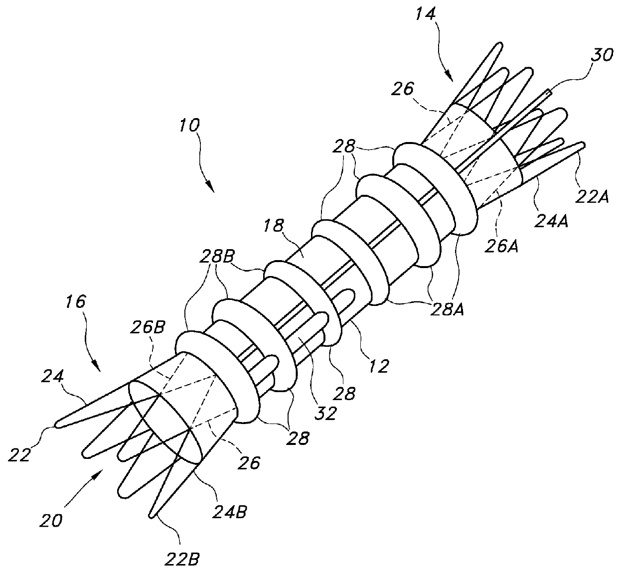 Advanced kink resistant stent graft