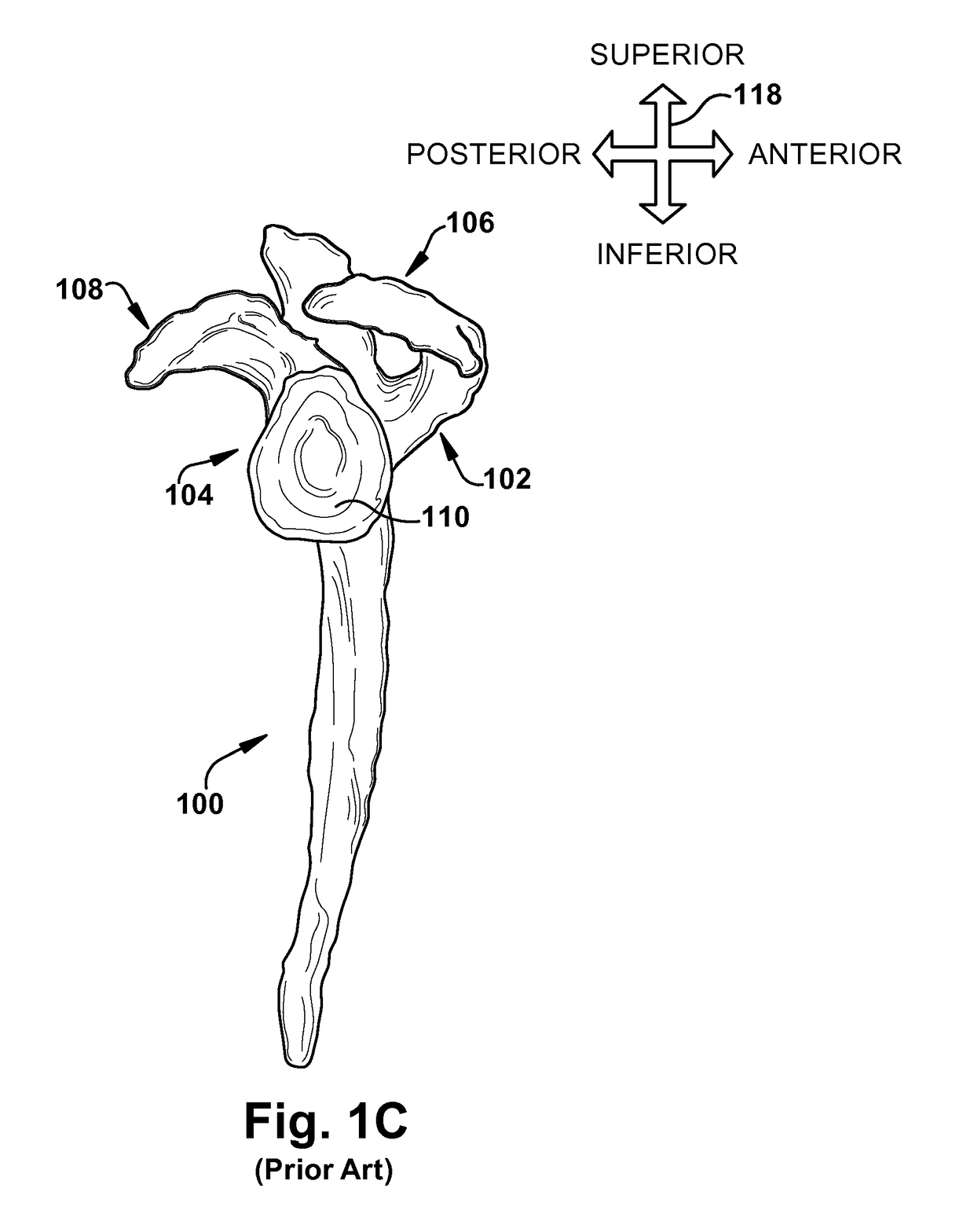 System of preoperative planning and provision of patient-specific surgical aids