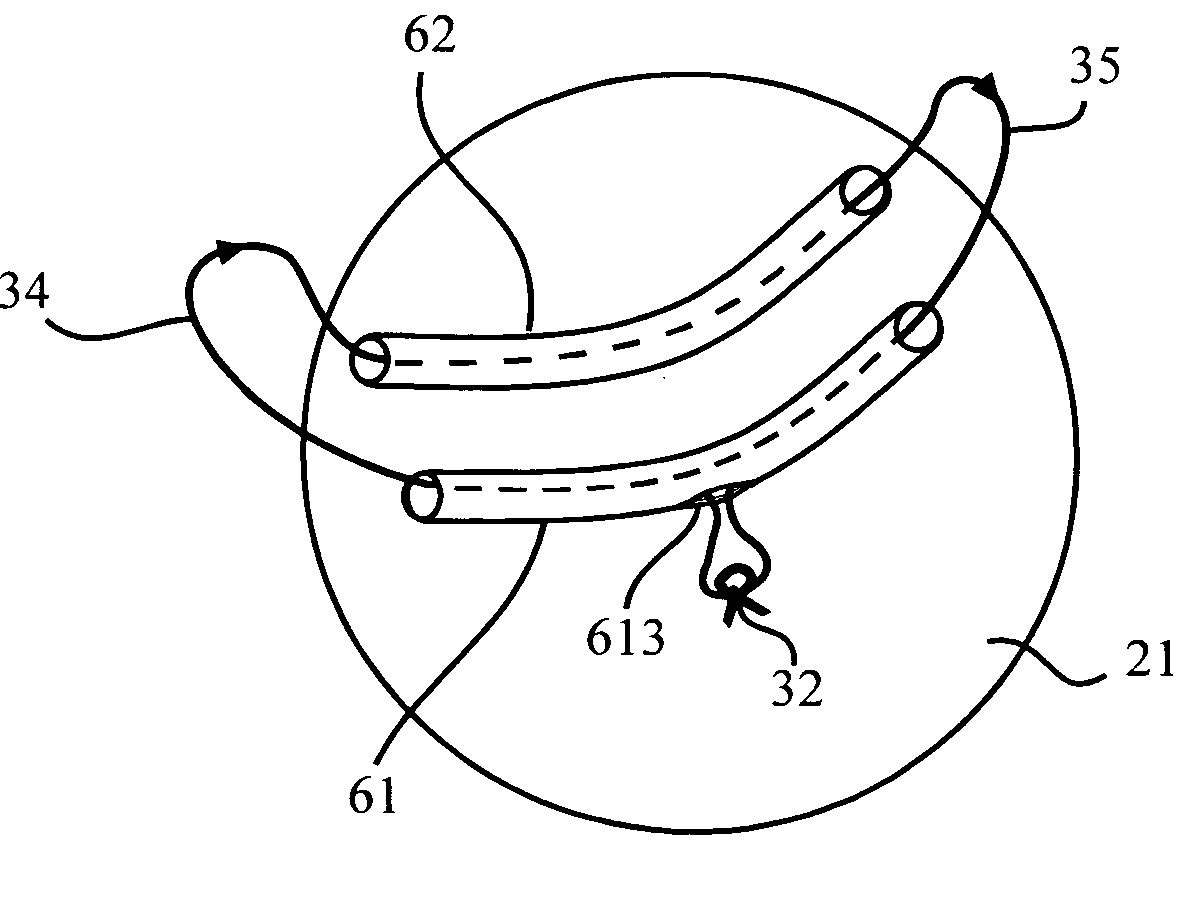 Implant device and method