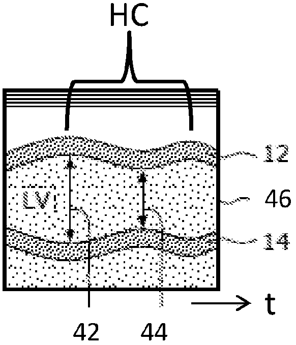 Ultrasound system and method for automated heartbeat recognition