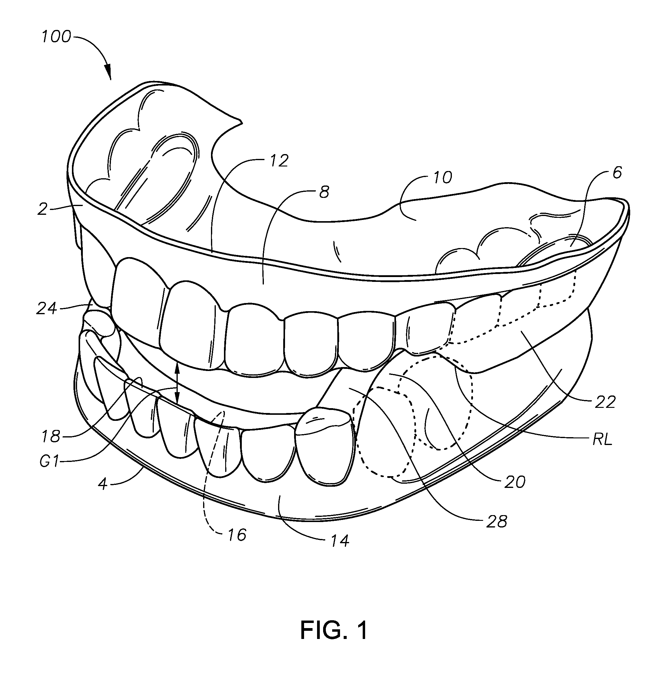 Oral devices